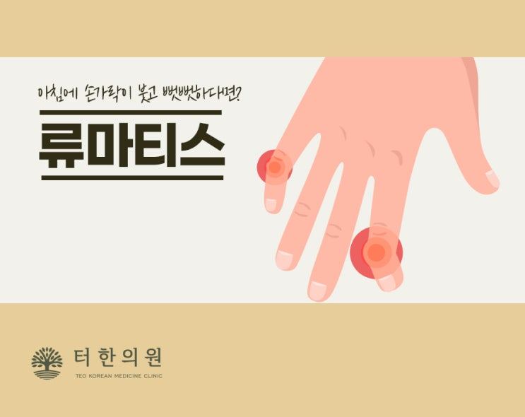류마티스 증상을 표시한 손 일러스트