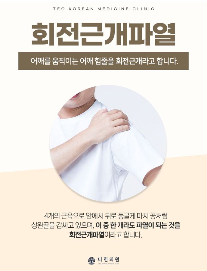 회전근개파열을 설명한 어깨 사진 안내문