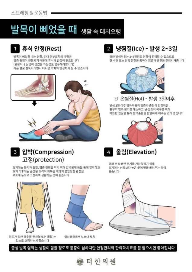 발목을 삐었을 때 휴식, 냉찜질, 압박, 올림 방법을 설명한 이미지